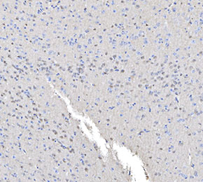 DARPP32 Antibody