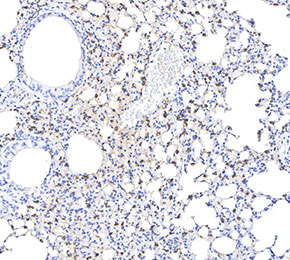 Prosurfactant Protein C Antibody