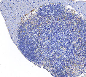 VEGF Receptor 2 Antibody