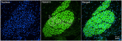 FBXW11 (BTRCP2 or NEDJED) (C-Terminus) Antibody - FFPE Validated
