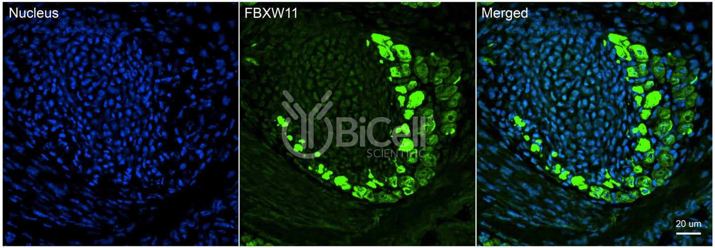 FBXW11 (BTRCP2 or NEDJED) (N-Terminus) Antibody