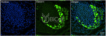 FBXW11 (BTRCP2 or NEDJED) (N-Terminus) Antibody