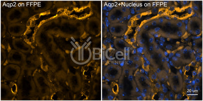 Aquaporin-2 (AQP2) (Rat) Antibody - FFPE Validated