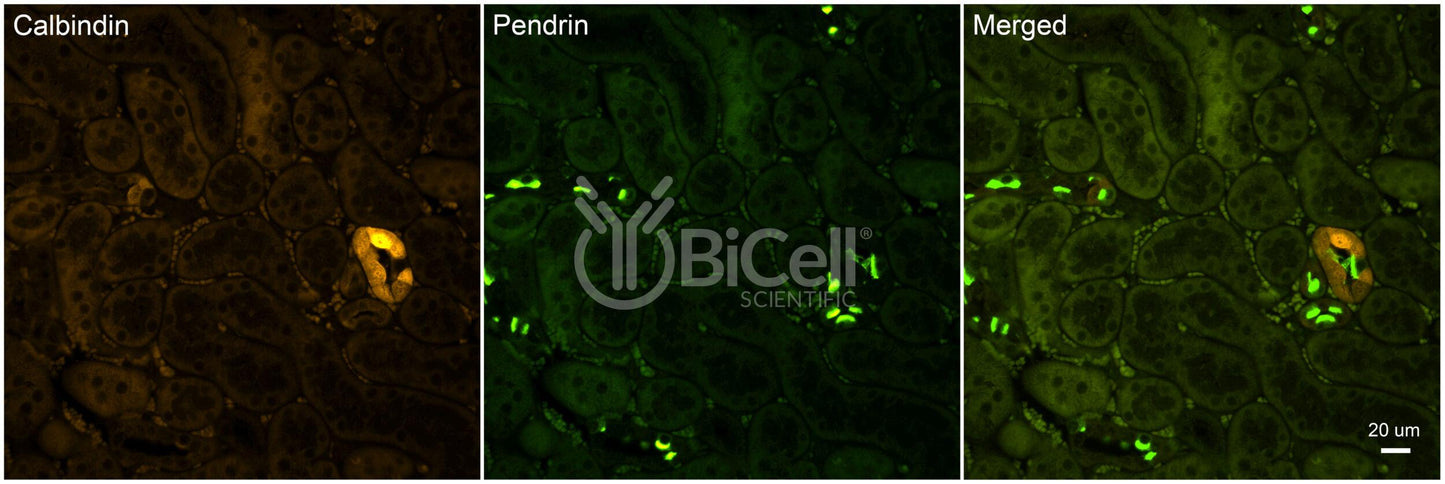 Calbindin-1 (CALB1 or Calbindin D-28K) Antibody - Western Blot Validated