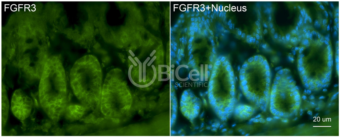 FGFR3 (CD333) Antibody