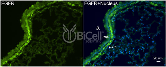 FGFR1 (FLT2 or CD331) Antibody - Western Blot Validated