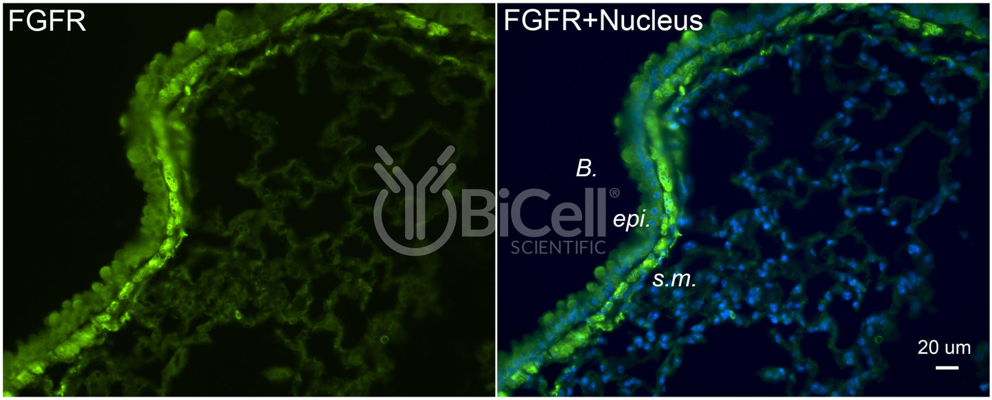 FGFR1 (FLT2 or CD331) Antibody - FFPE Validated