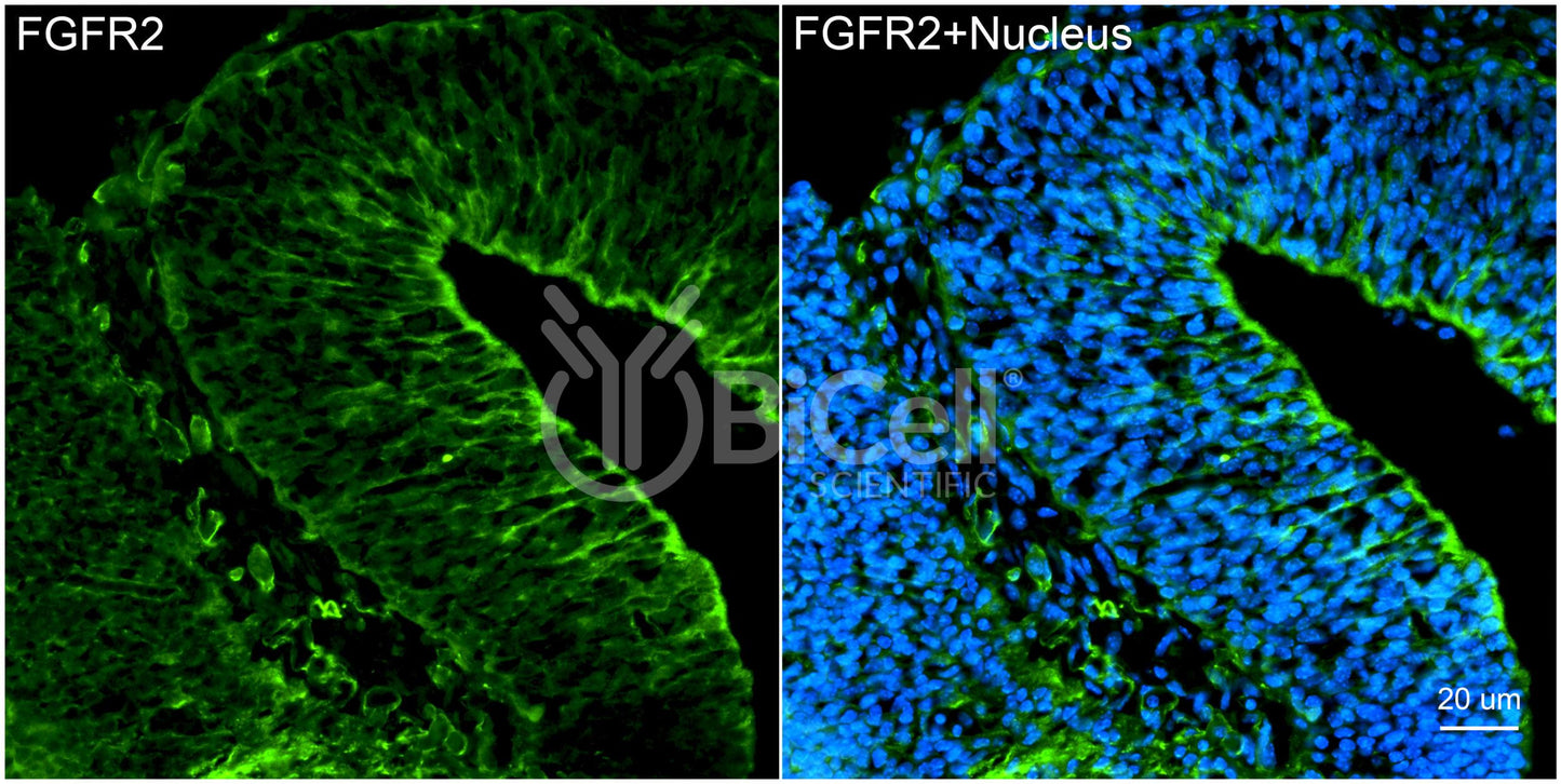 FGFR2 (CD332) Antibody - FFPE Validated