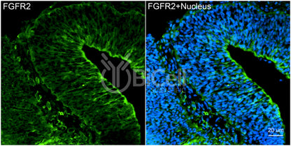 FGFR2 (CD332) Antibody
