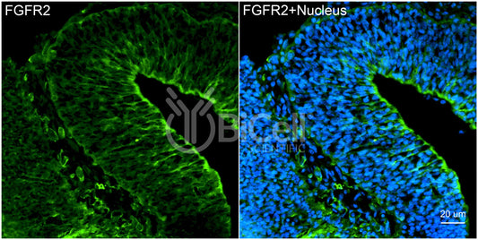 FGFR2 (CD332) Antibody
