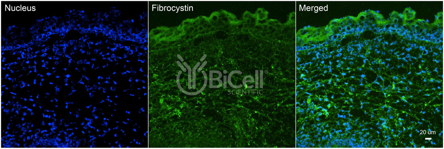 Fibrocystin (PKHD1 or ARPKD or PKD4) Antibody - FFPE Validated