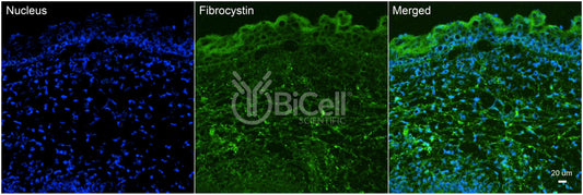 Fibrocystin (PKHD1 or ARPKD or PKD4) Antibody