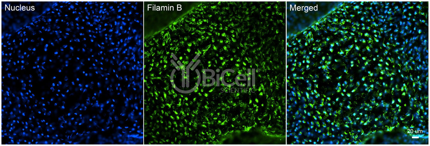 Filamin B (FLNB) Antibody - FFPE Validated