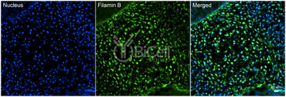 Filamin B (FLNB) Antibody - FFPE Validated