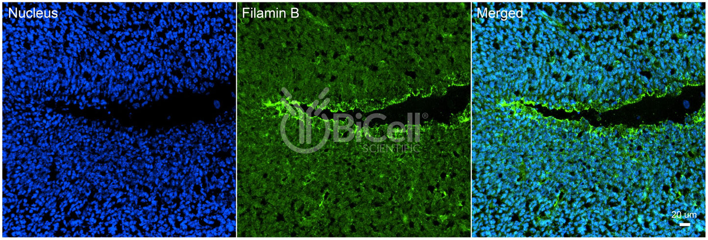 Filamin B (FLNB) Antibody