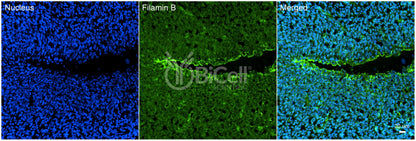 Filamin B (FLNB) Antibody