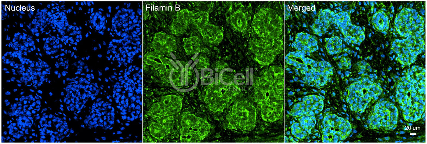 Filamin B (FLNB) Antibody - Western Blot Validated