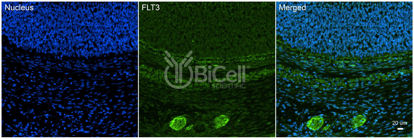 FLT3 (FLK2 or STK1 or CD135) Antibody - Western Blot Validated