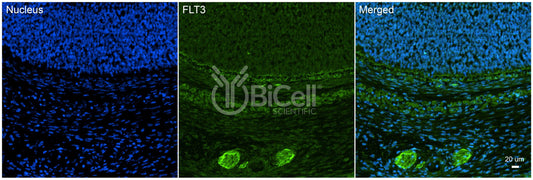 FLT3 (FLK2 or STK1 or CD135) Antibody