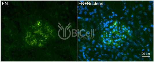 Fibronectin (FN1 or FN) Antibody