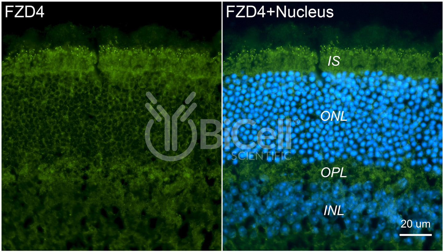 Frizzled-4 (FZD4) Antibody - FFPE Validated