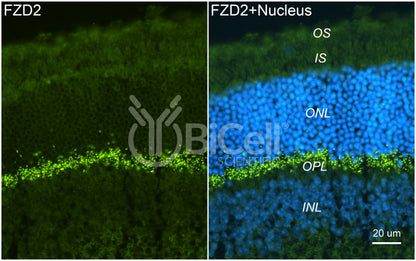 Frizzled-2 (FZD2) Antibody - FFPE Validated