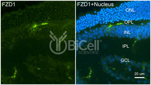 Frizzled-1 (FZD1) Antibody - Western Blot Validated