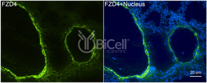 Frizzled-4 (FZD4) Antibody - FFPE Validated