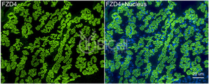 Frizzled-4 (FZD4) Antibody - FFPE Validated
