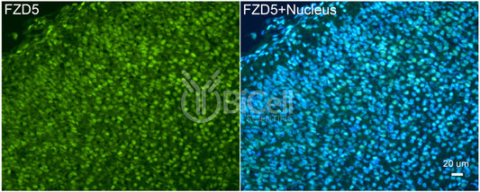 Frizzled-5 (FZD5) Antibody - Western Blot Validated