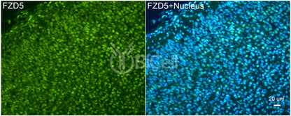 Frizzled-5 (FZD5) Antibody