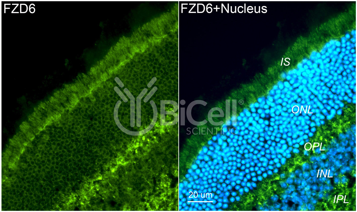 Frizzled-6 (FZD6) Antibody - FFPE Validated