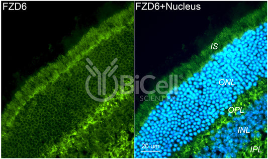 Frizzled-6 (FZD6) Antibody - FFPE Validated