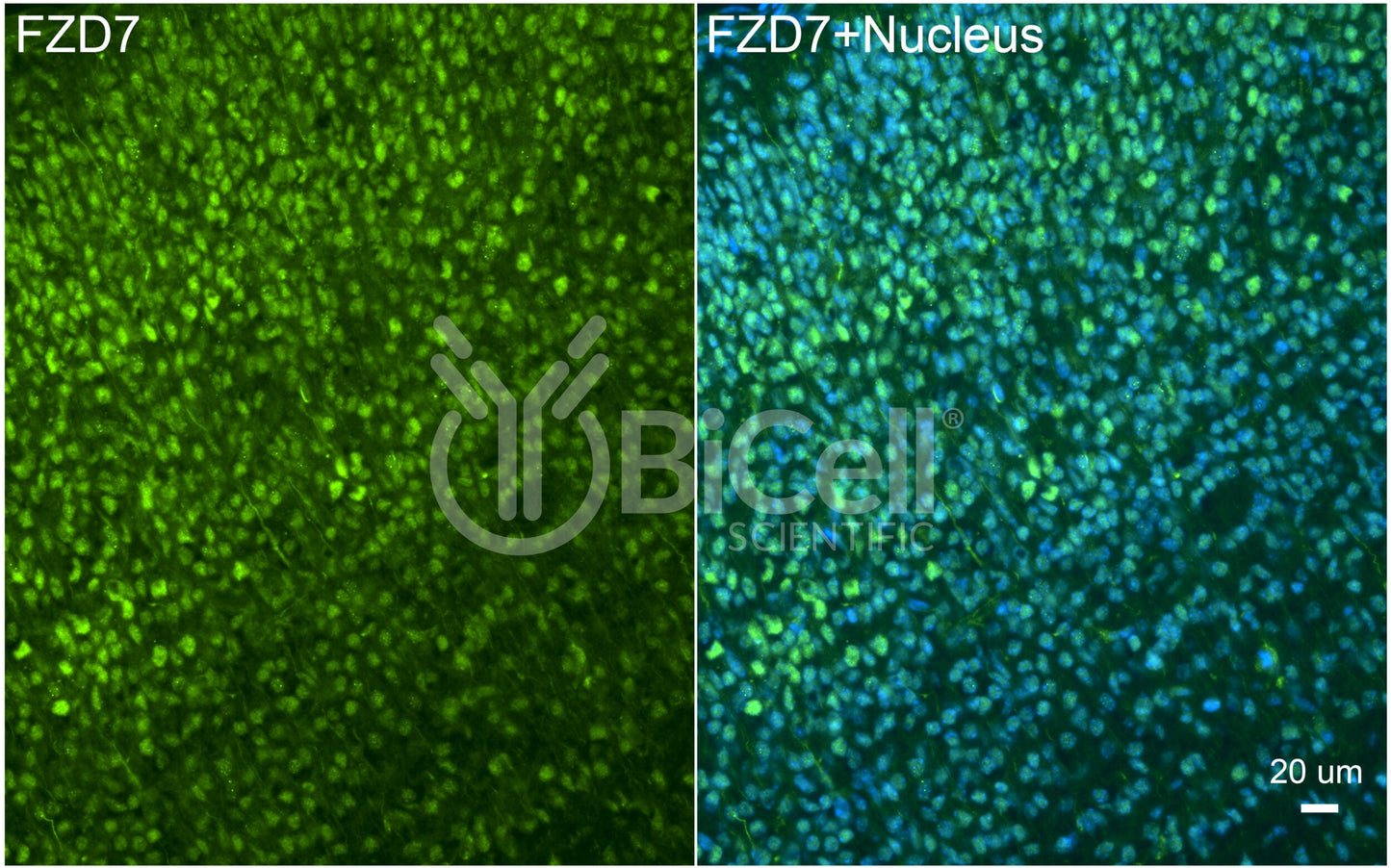 Frizzled-7 (FZD7) Antibody - Western Blot Validated