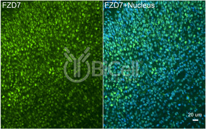 Frizzled-7 (FZD7) Antibody - Western Blot Validated
