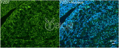 Frizzled-7 (FZD7) Antibody - Western Blot Validated