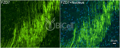 Frizzled-7 (FZD7) Antibody - FFPE Validated