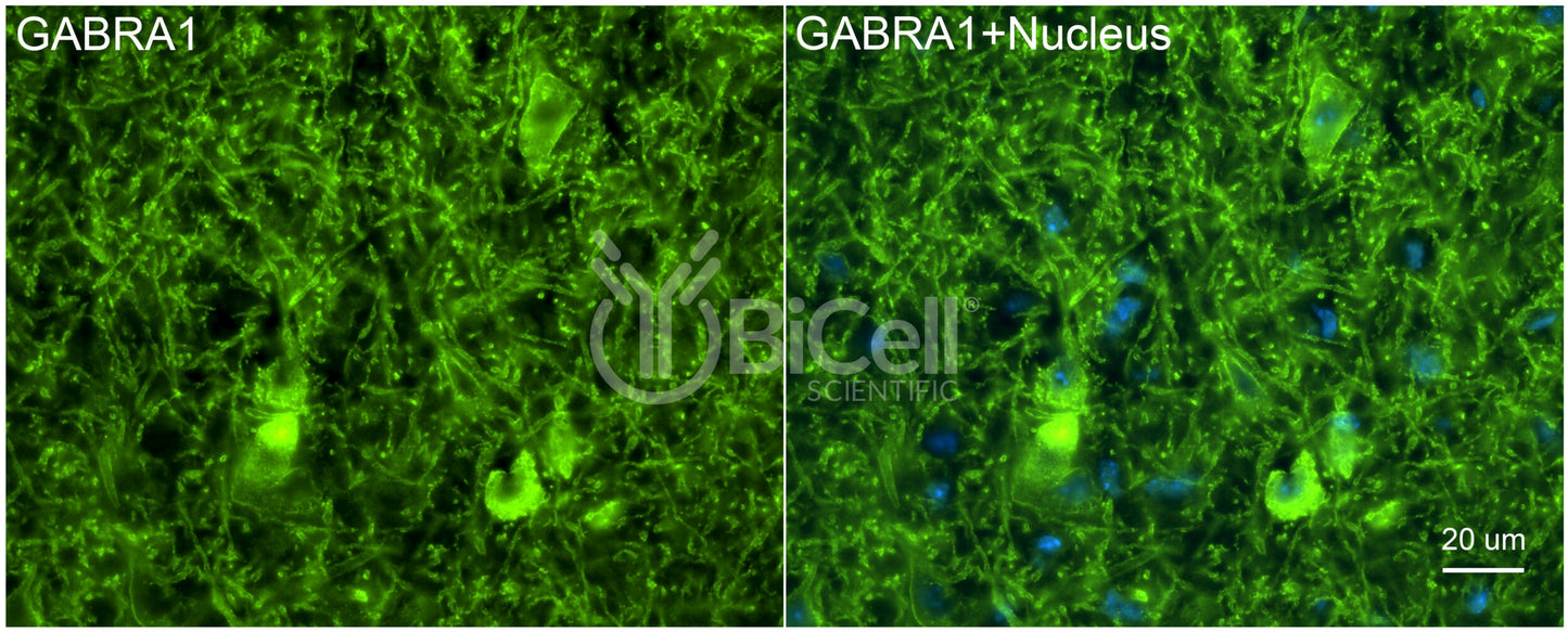 GABRA1 Antibody - FFPE Validated