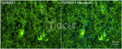 GABRA1 Antibody - FFPE Validated