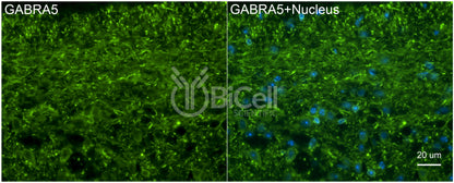 GABRA5 Antibody - FFPE Validated