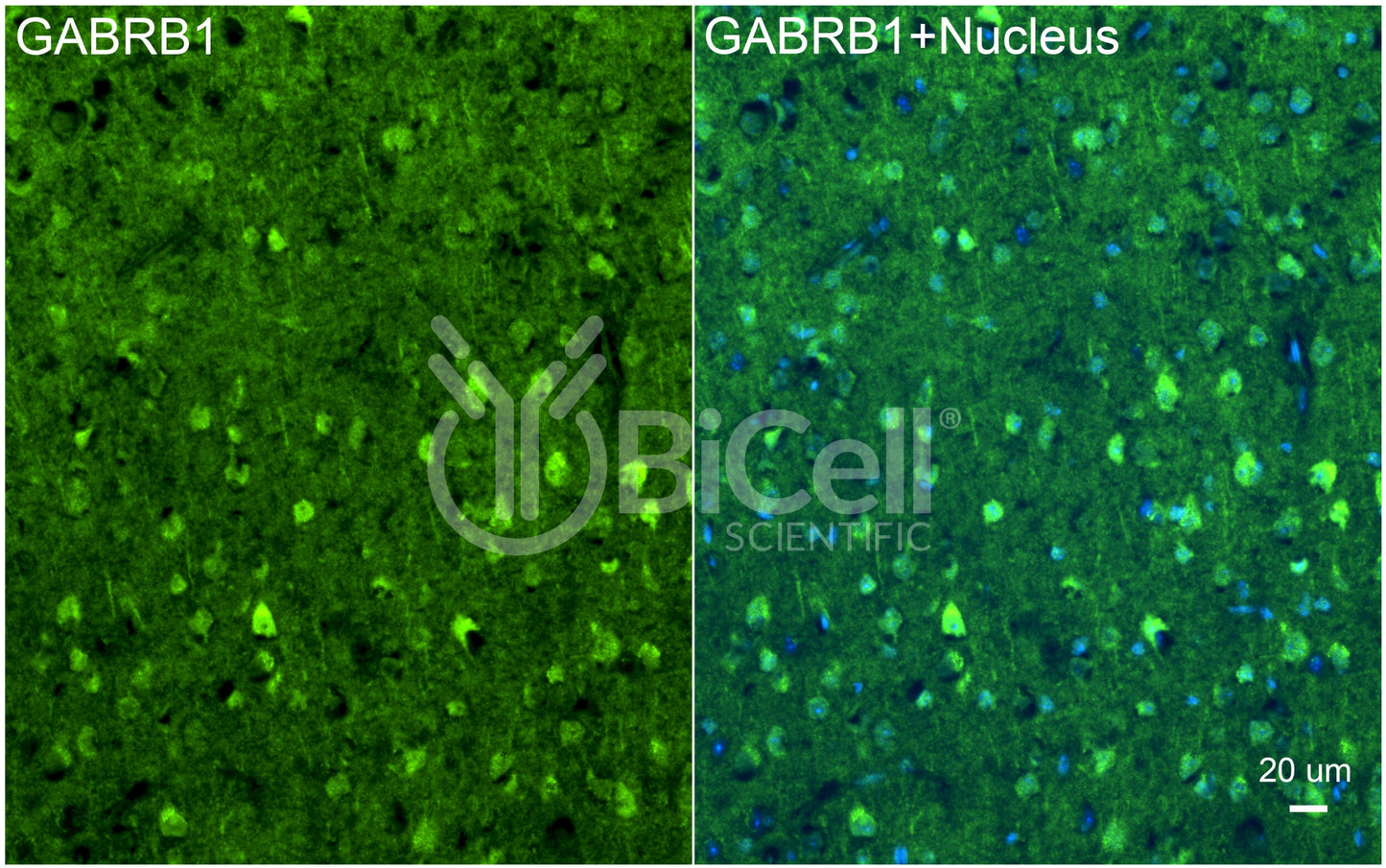GABRB1 Antibody - FFPE Validated