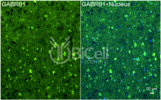 GABRB1 Antibody - FFPE Validated