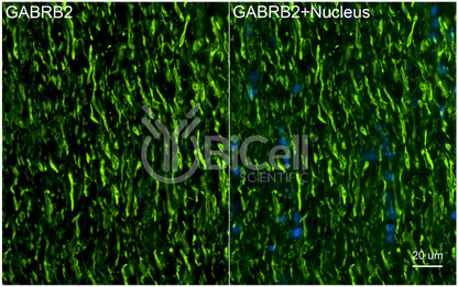 GABRB2 Antibody - FFPE Validated