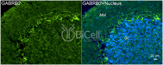 GABRB2 Antibody - Western Blot Validated