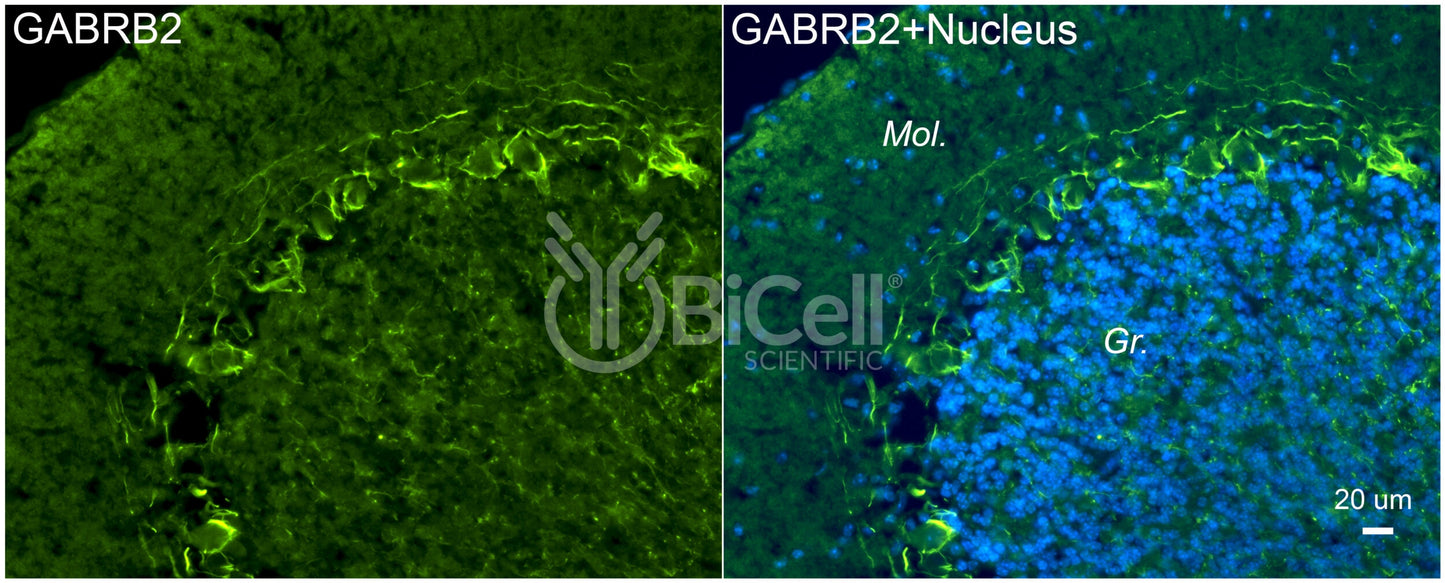 GABRB2 Antibody - FFPE Validated