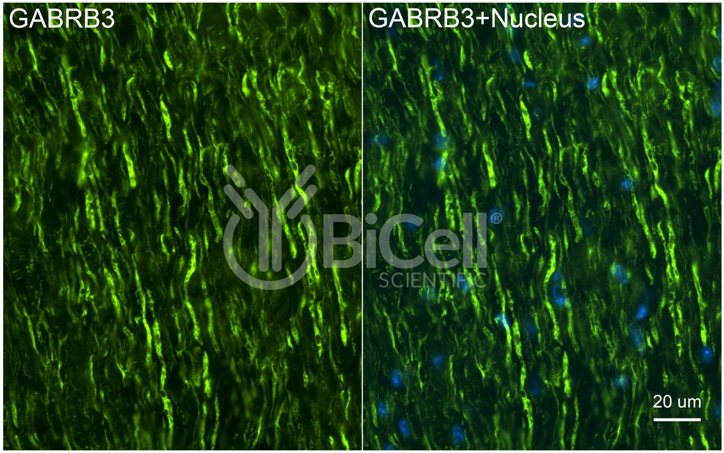 GABRB3 Antibody - FFPE Validated