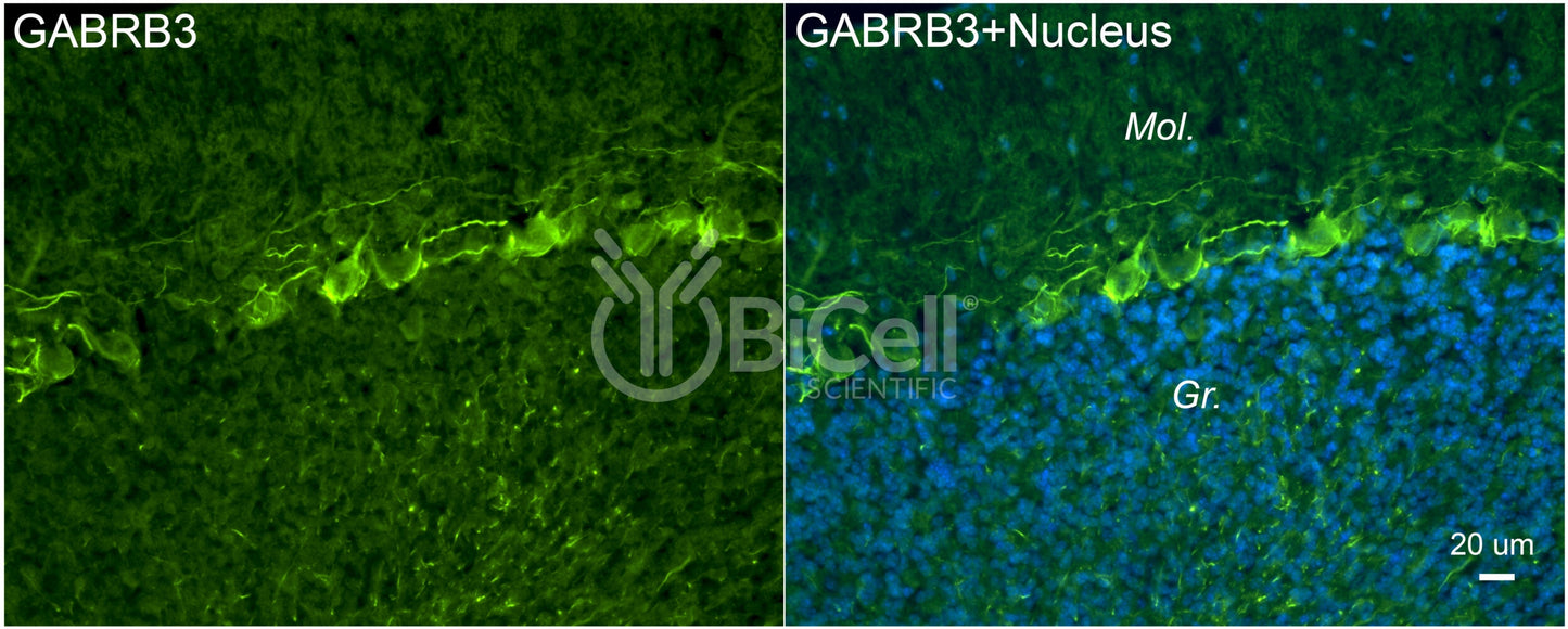 GABRB3 Antibody - FFPE Validated