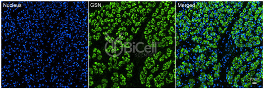 Gelsolin (GSN) Antibody