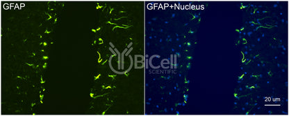 GFAP Antibody