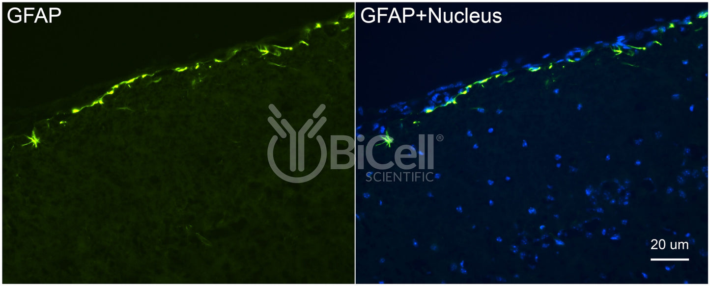 GFAP Antibody - Western Blot Validated